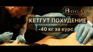 МОЩНЕЙШАЯ ПРОЦЕДУРА ДЛЯ ПОХУДЕНИЯ! БЕЗ ДИЕТ И СПОРТА МИНУС 40 КГ. КЕТГУТ ТЕРАПИЯ - ПОХУДЕНИЕ.