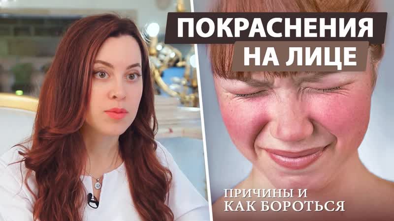 Как бороться с расширенными сосудами на