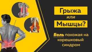 Боль в спине, отдает в ногу. Как не спутать грыжу с болью в мышцах Техники и приемы.