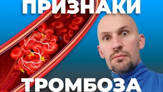 Признаки тромбоза