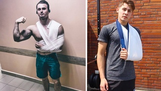 5 худших травм в воркауте. Последствия рекордов!