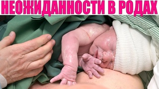 ЧТО НЕОЖИДАННОГО МОЖЕТ ПРОИЗОЙТИ ВО ВРЕМЯ РОДОВ | 6 вещей которые вы не ожидаете во время родов