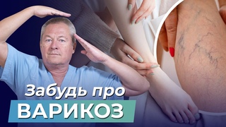 ВАРИКОЗ Не БЕДА! Делайте ЭТО УПРАЖНЕНИЕ каждый день и ЗАБУДЬТЕ ПРО ВАРИКОЗ!
