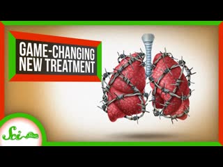 New Cystic Fibrosis Treatment a Game-Changer | SciShow News