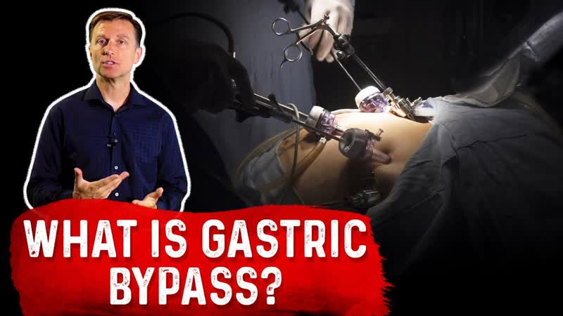 What is Gastric Bypass Dr.