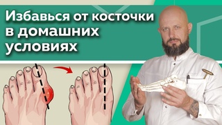 Как избавиться от шишки на ноге / Эффективные упражнения для восстановления суставов