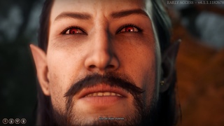 Astarion's nightmare about Cazador Baldur's Gate 3 Astarion Origin Patch 5
