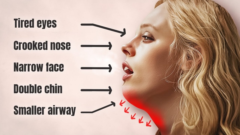 Mouth breathing is killing