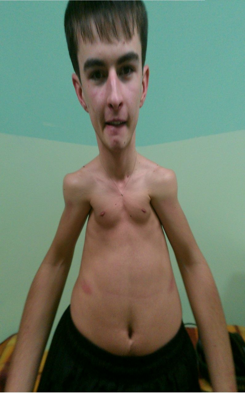 Марат Шашков | Ханты-Мансийск