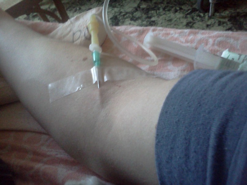 Илья Чек | Витебск