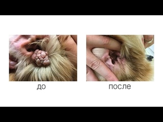 FreezPen - выдающиеся результаты лечения