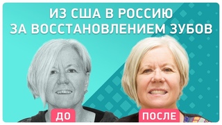 All-on-4 имплантация  цена в России ниже, чем в США! Отзыв реального пациента