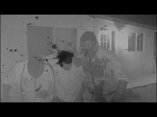 The Osteoblasts - “Nosebleed“ OFFICIAL VIDEO