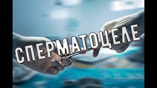 Операция при сперматоцеле