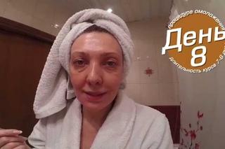 Ретиноевый (желтый) пилинг. Восьмой день эксперимента (заключительный)