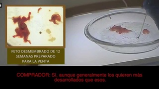 Bebs desmembrados a la venta: el trfico de rganos de Planned Parenthood