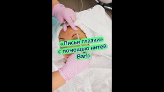 ТОП-3 самых популярных процедур мезонитями