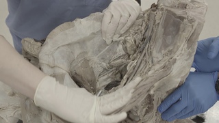 Pelvic Inlet & Perineum -- male calf
