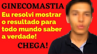 GINECOMASTIA MEUS RESULTADOS ANTES E DEPOIS DA GINECOMASTIA