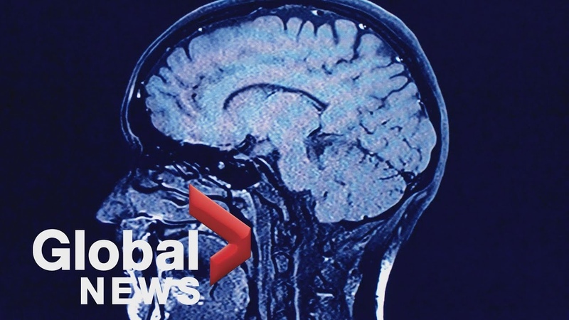 Investigating New Brunswicks mysterious, fatal brain